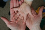 Picture illustrating Joint Strategic Needs Assessment (JSNA) project